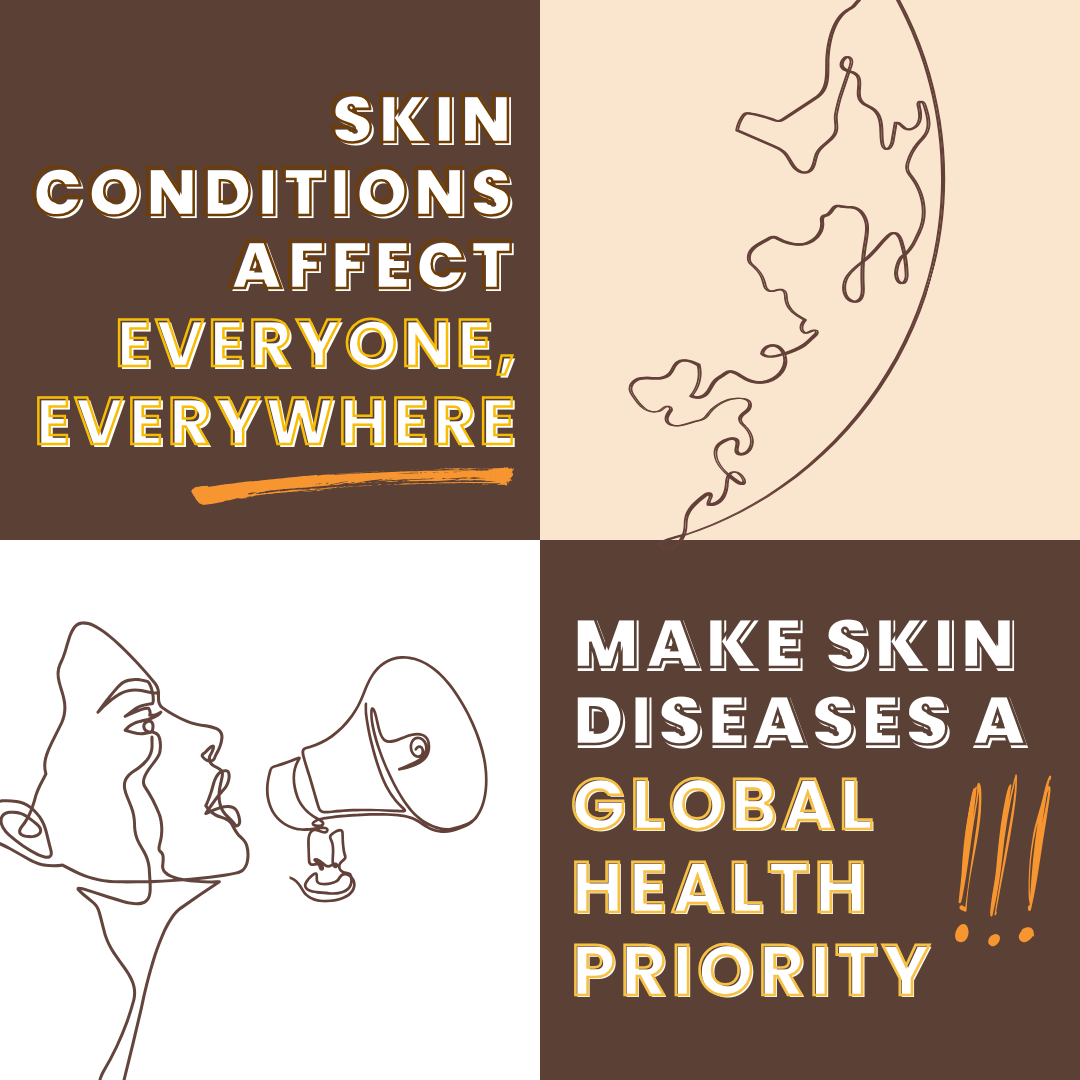 SkinConditionsAffectEveryone