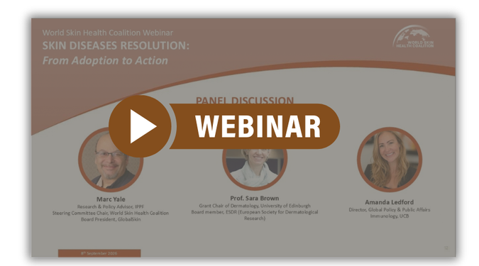 webinar replay (2)